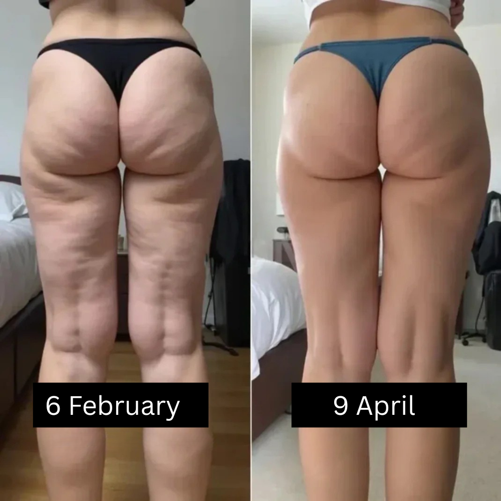 3D Anti-Cellulite Eloxa Leggings