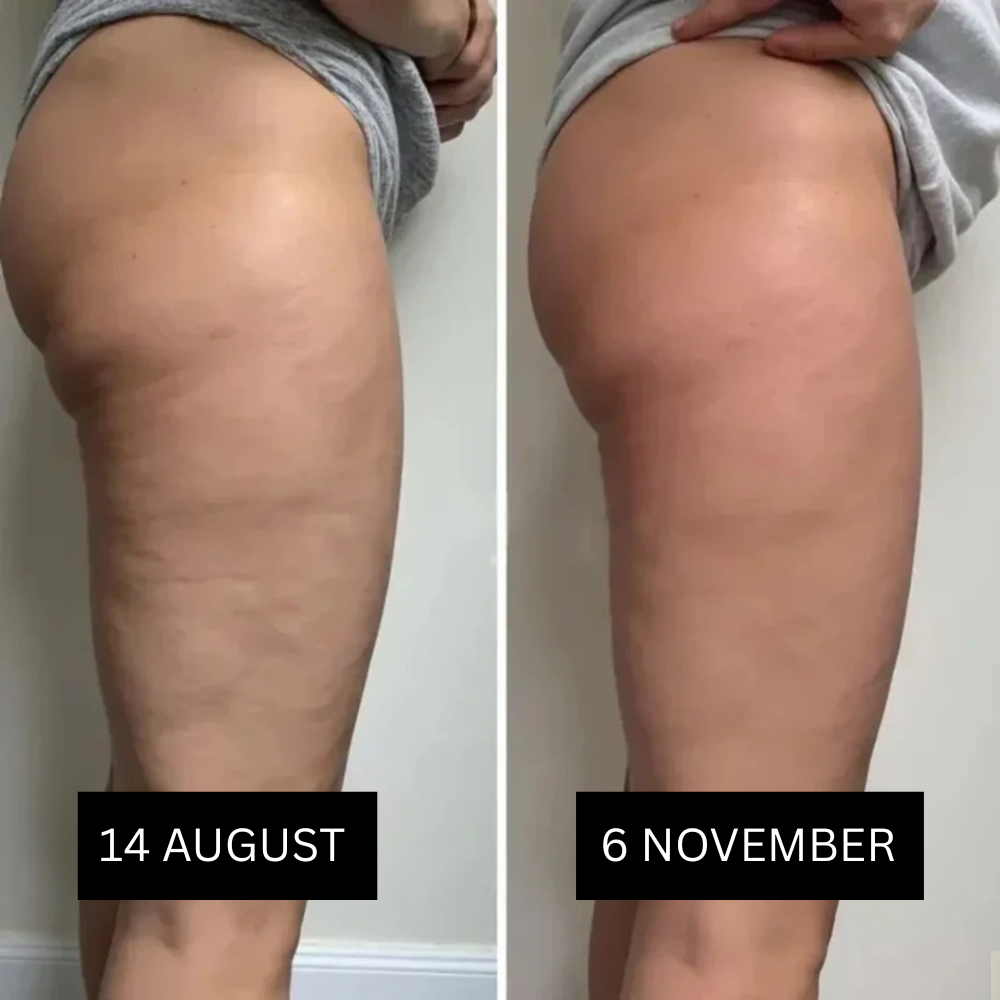 3D Anti-Cellulite Eloxa Leggings