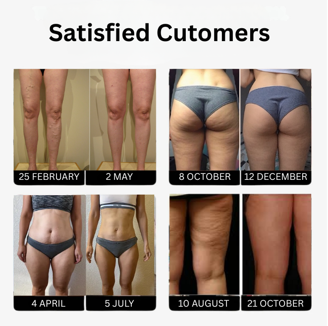 3D Anti-Cellulite Eloxa Leggings