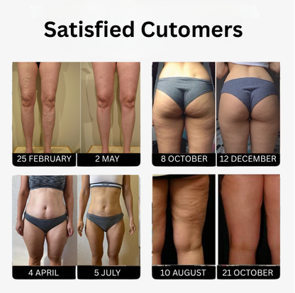 3D Anti-Cellulite Eloxa Leggings